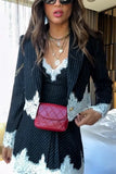 Spring Lace Patchwork Streetwear Dress Of Set 2025 New Fashion Stripe Blazer Coat And Slip Short Dress Fashion Two Piece Set